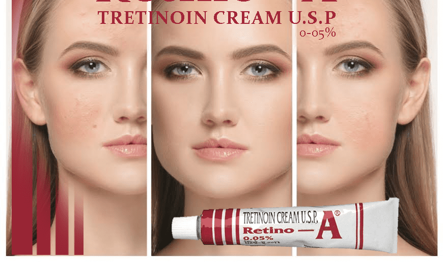 tretinoin cream